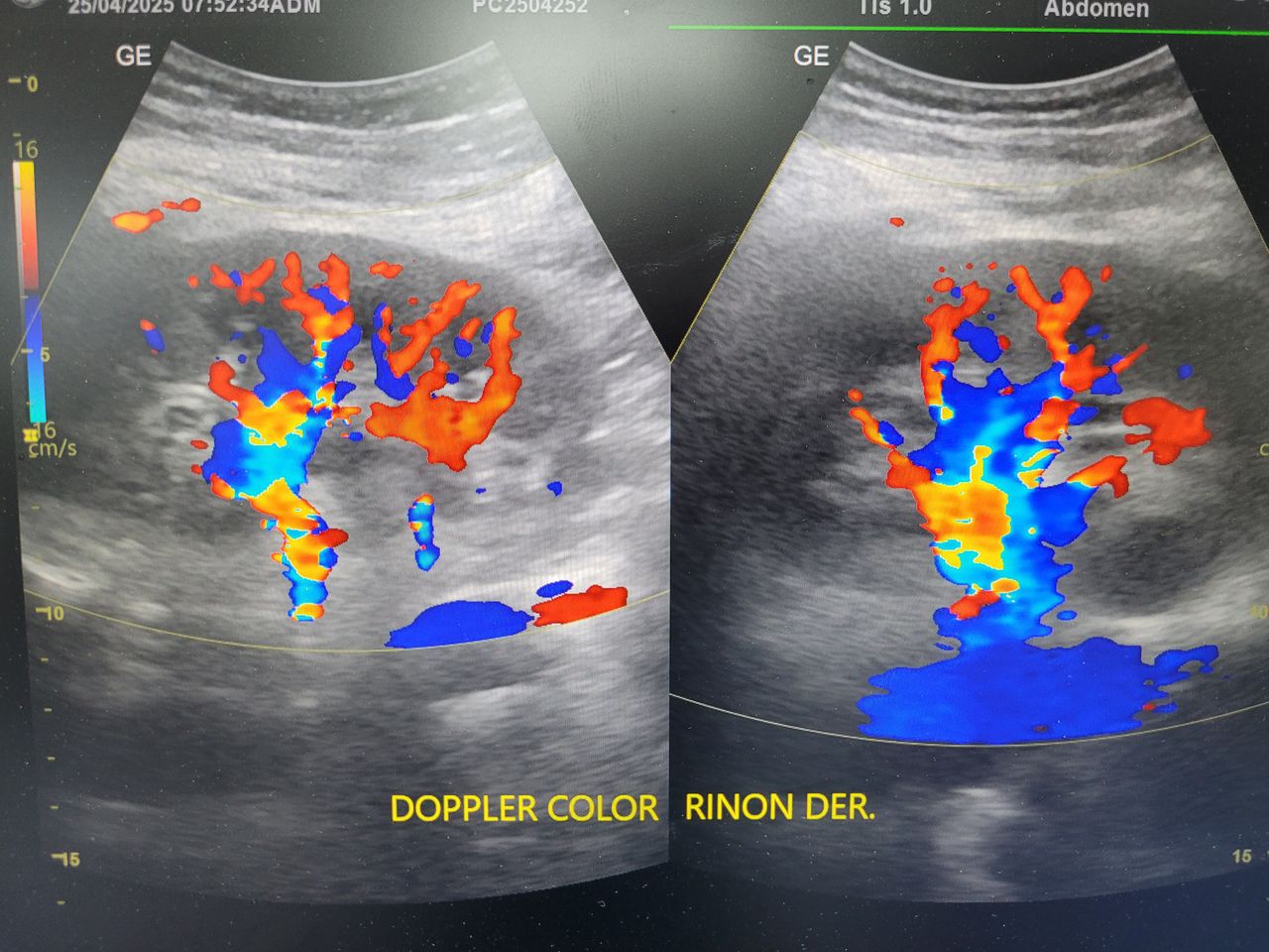 Einar Arik Nuñez Sanchez-7