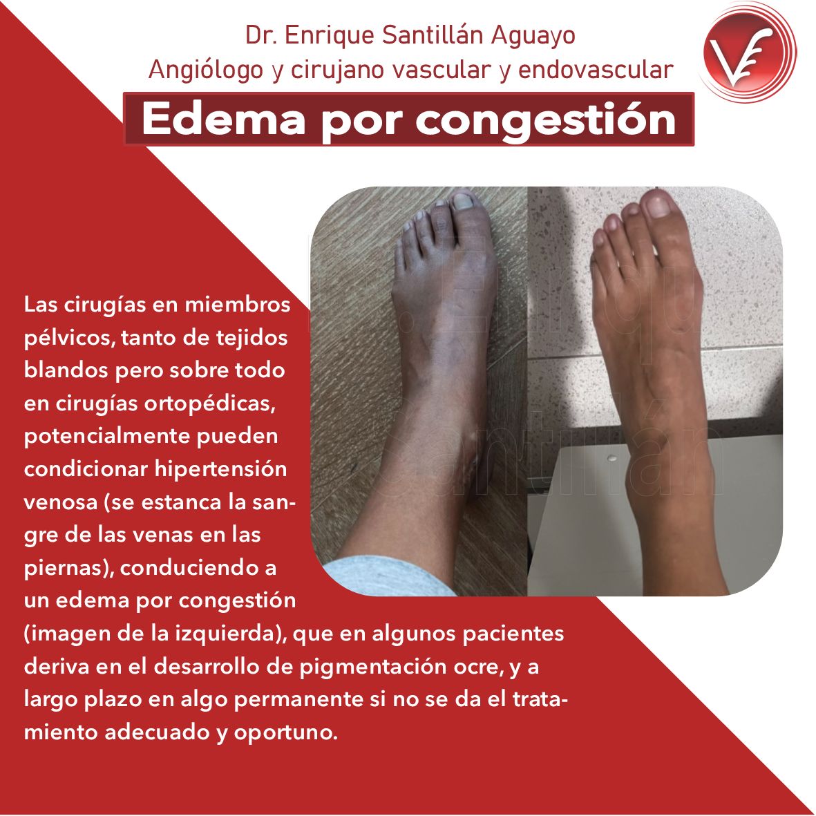 Enrique Santillán Aguayo-7