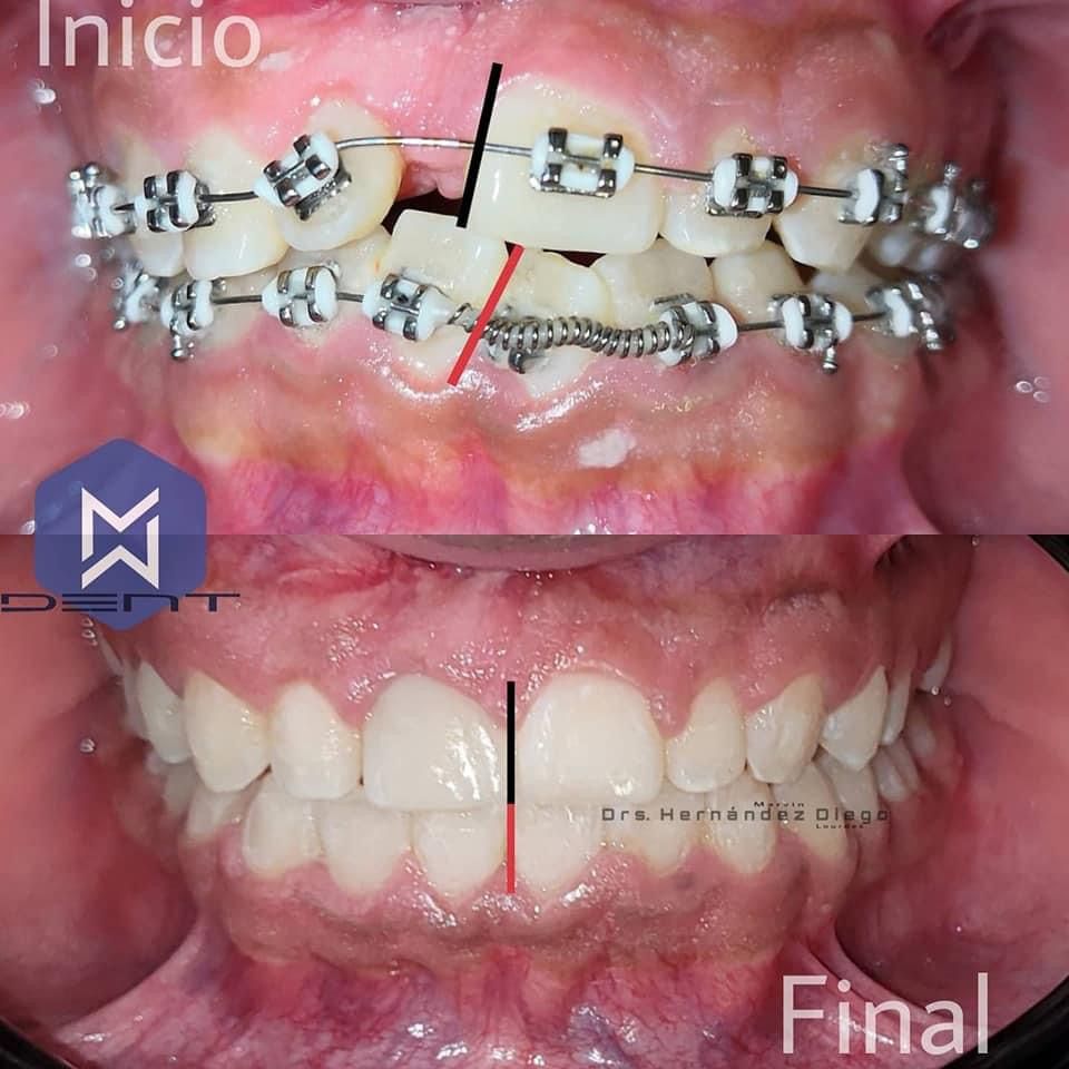 Marvin Adair Hernández Álvarez-51