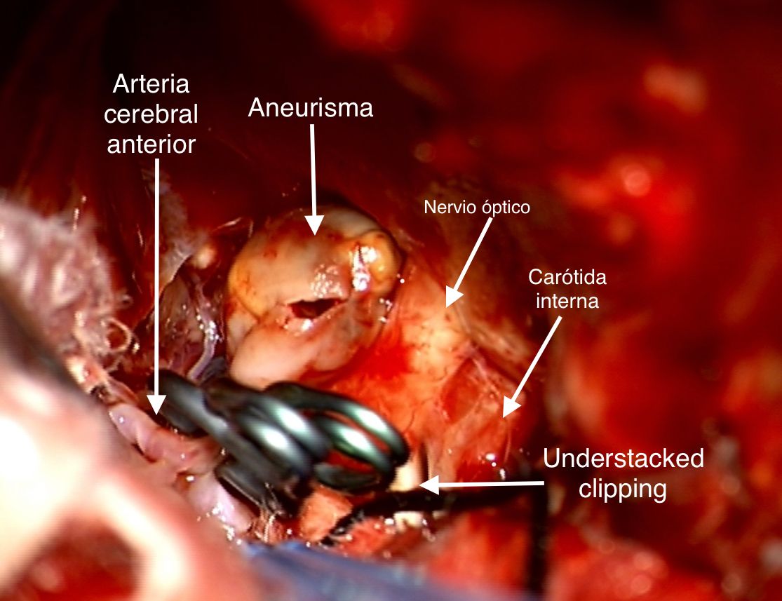 Celia Teresa De Jesús Álvarez Gamiño-30