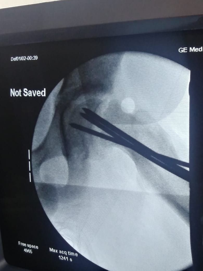 Alberto Viñas Silva-17