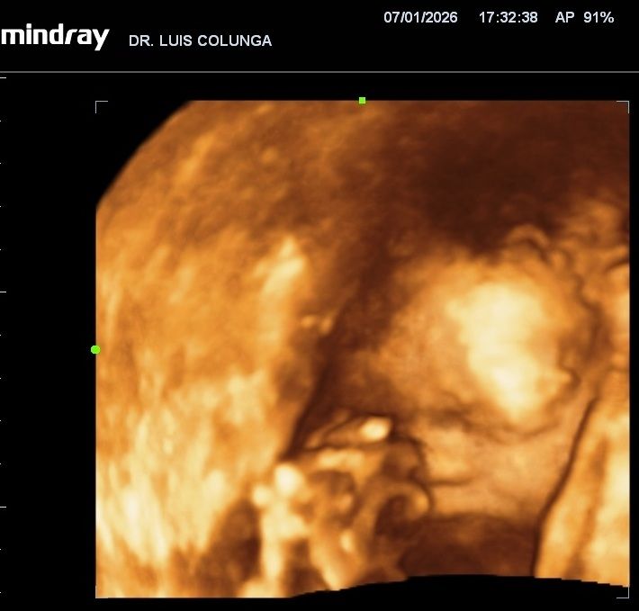 Luis Antonio Colunga González-1