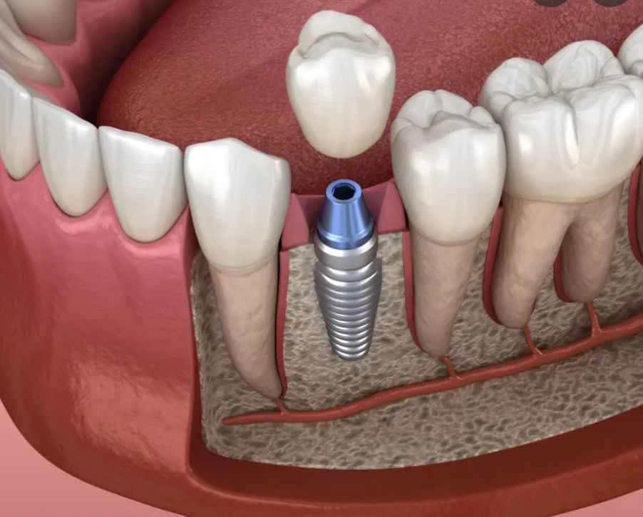 Neguib Villavicencio Raful-34