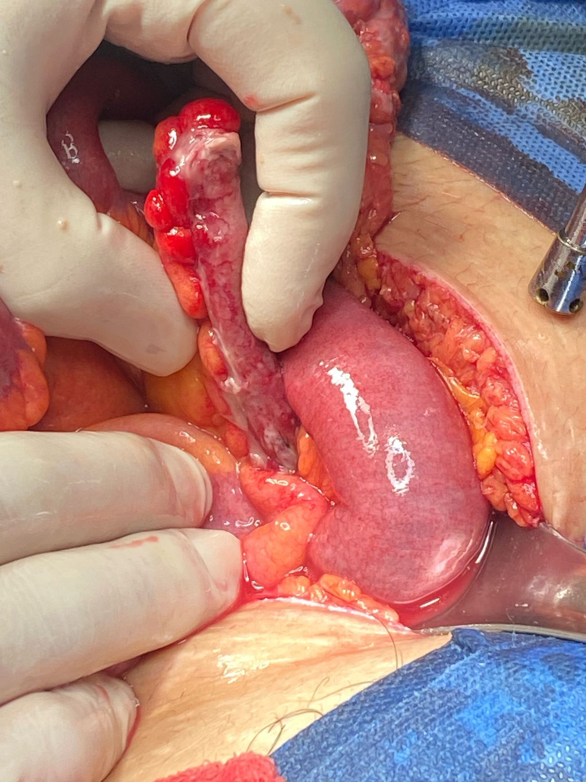 Alejandro Bailón Calderón-0