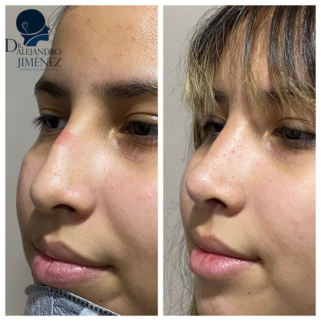 Alejandro Jimenez Garcia-20