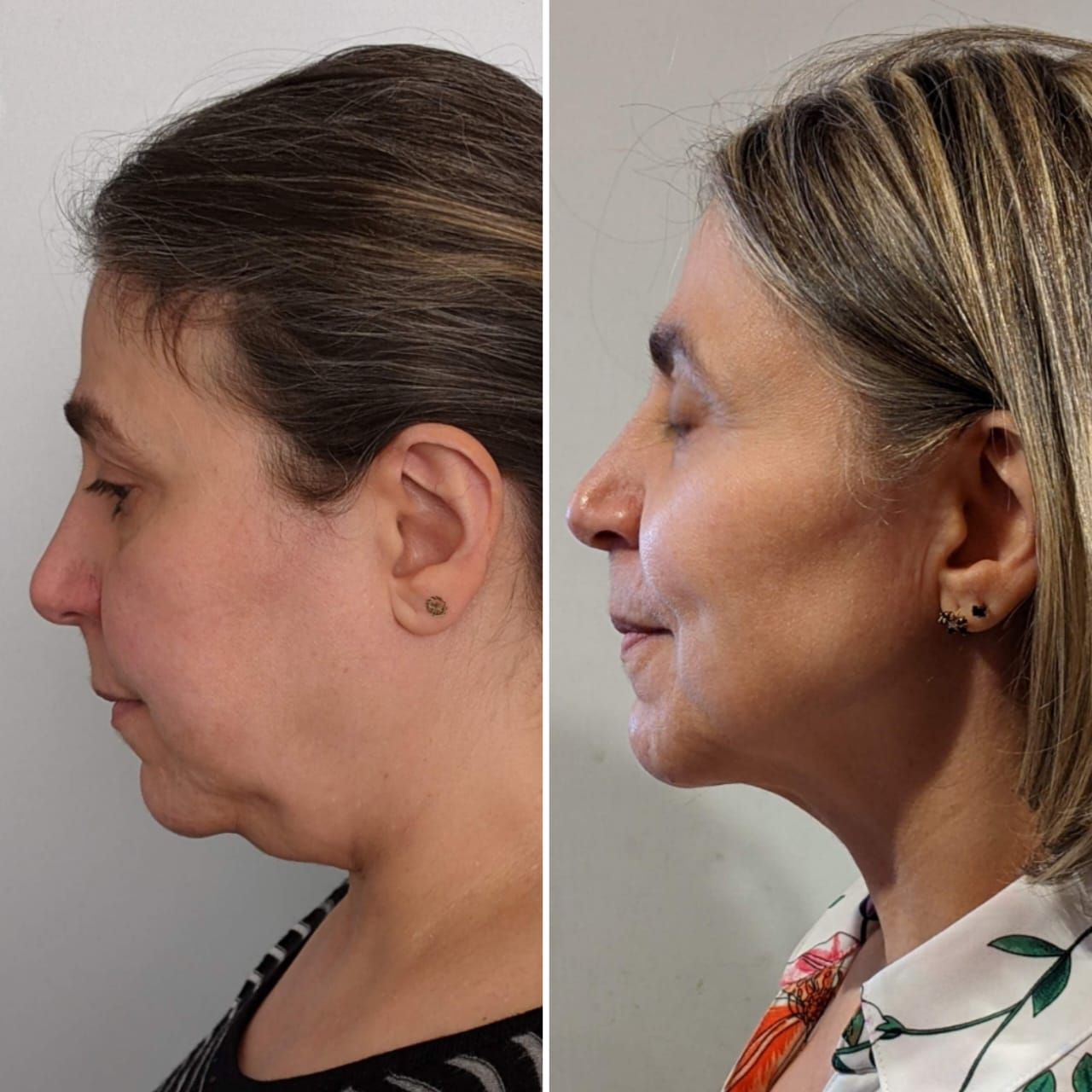 Alberto Guakil Haber-10