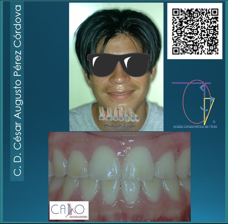 César Augusto Pérez Córdova-20