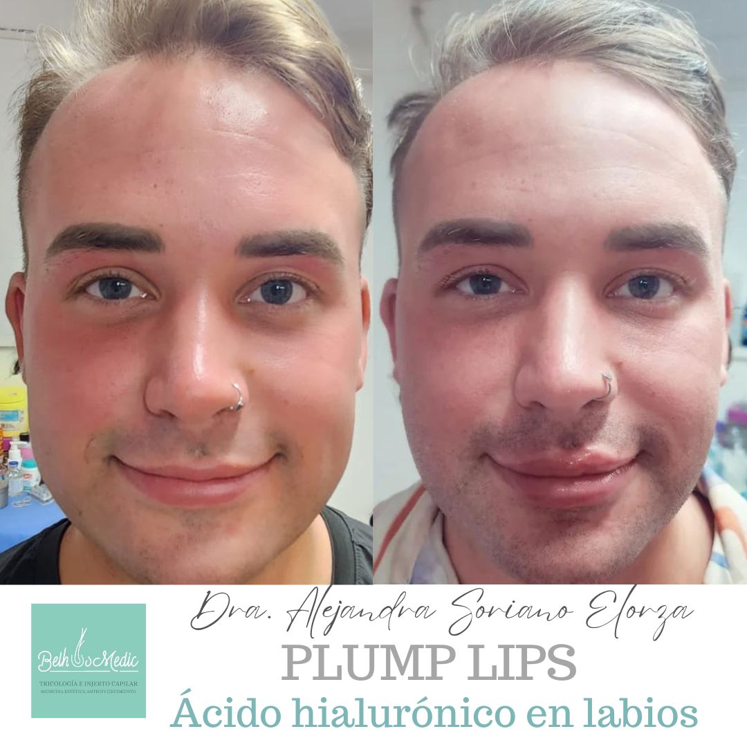 Alejandra Soriano Elorza-30