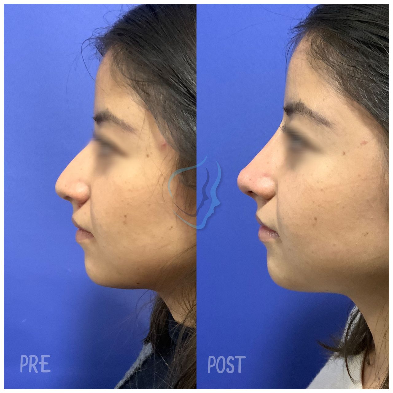 Giuseppe Tanzillo-75