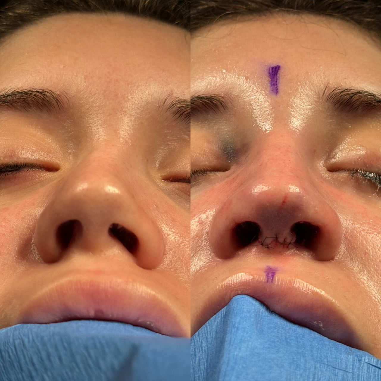 Angel Castro Urquizo-26