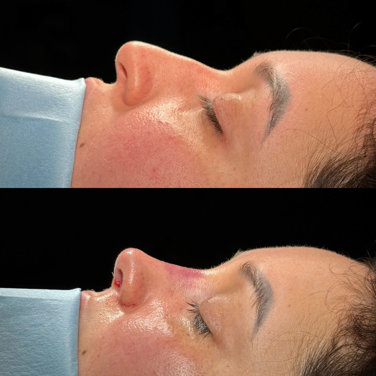 Angel Castro Urquizo-101