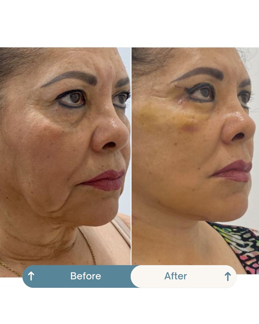 Nashielli Torres Espinosa Chiu-14