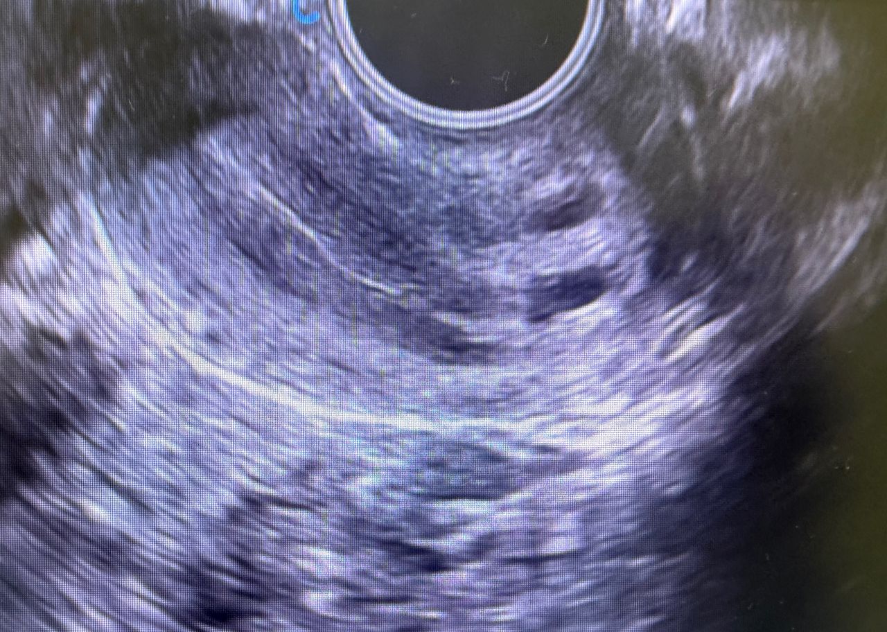 Mauricio Polanco Lepe-1