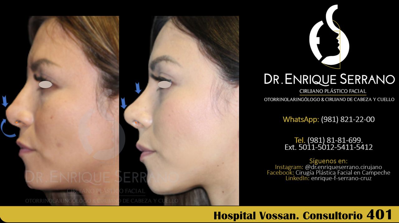 Enrique Serrano Cruz-111