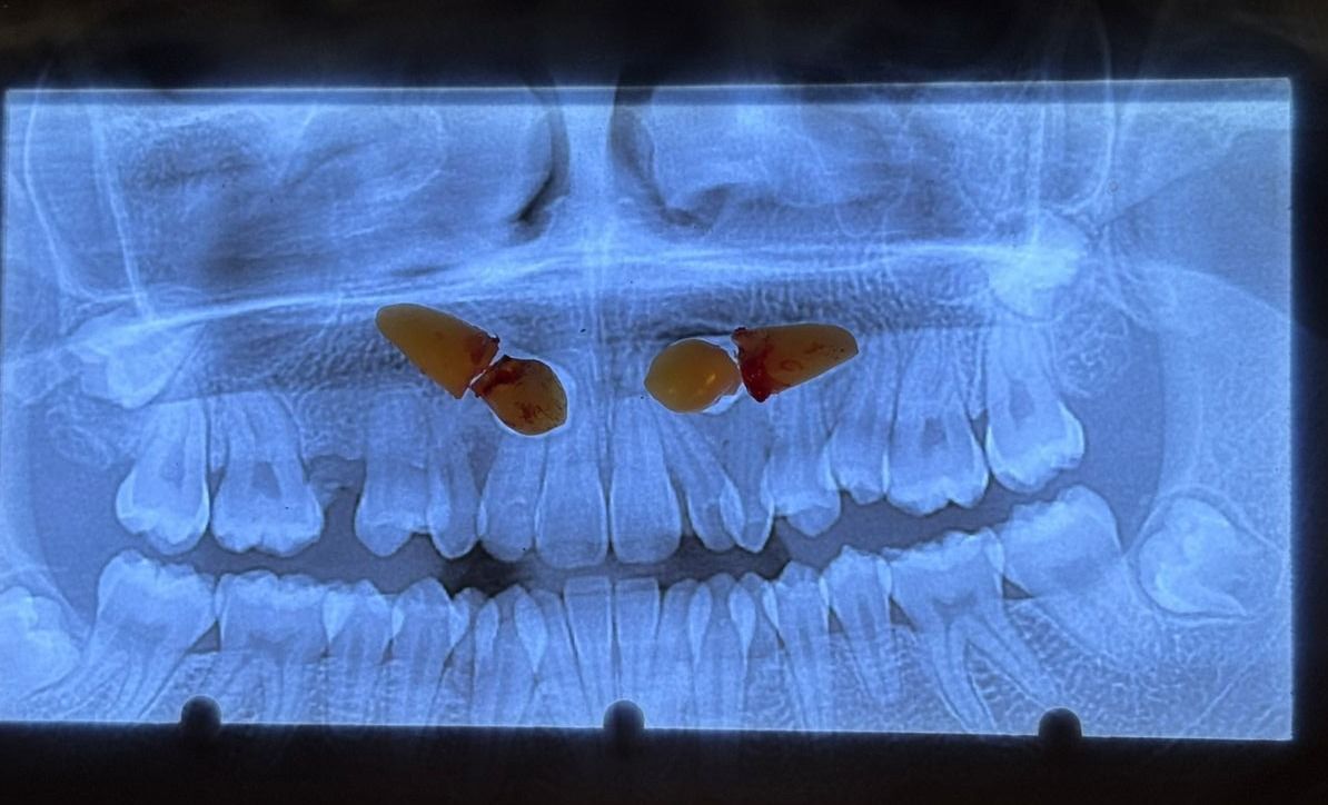 Francisco Javier Ríos Ángeles-3