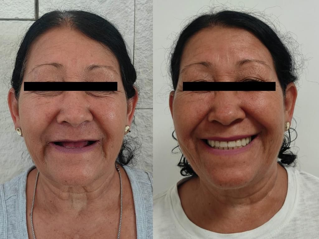 Ana Cecilia Chapa Kindling-8