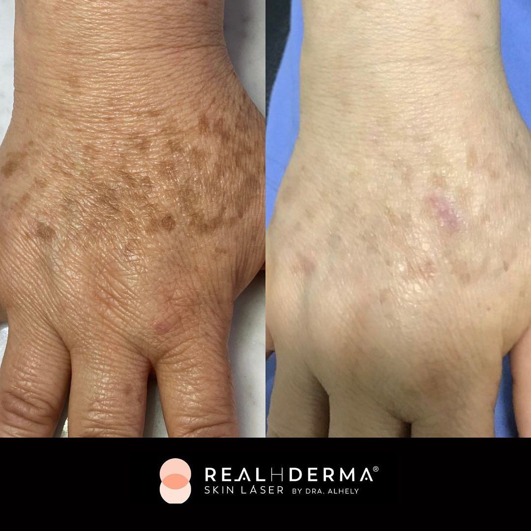 Laura Alheli Niebla Maldonado-14