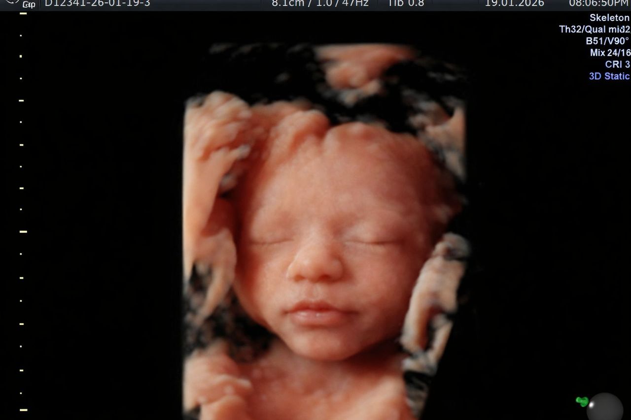 Graciela Elizabeth De La Torre Alvarez-26