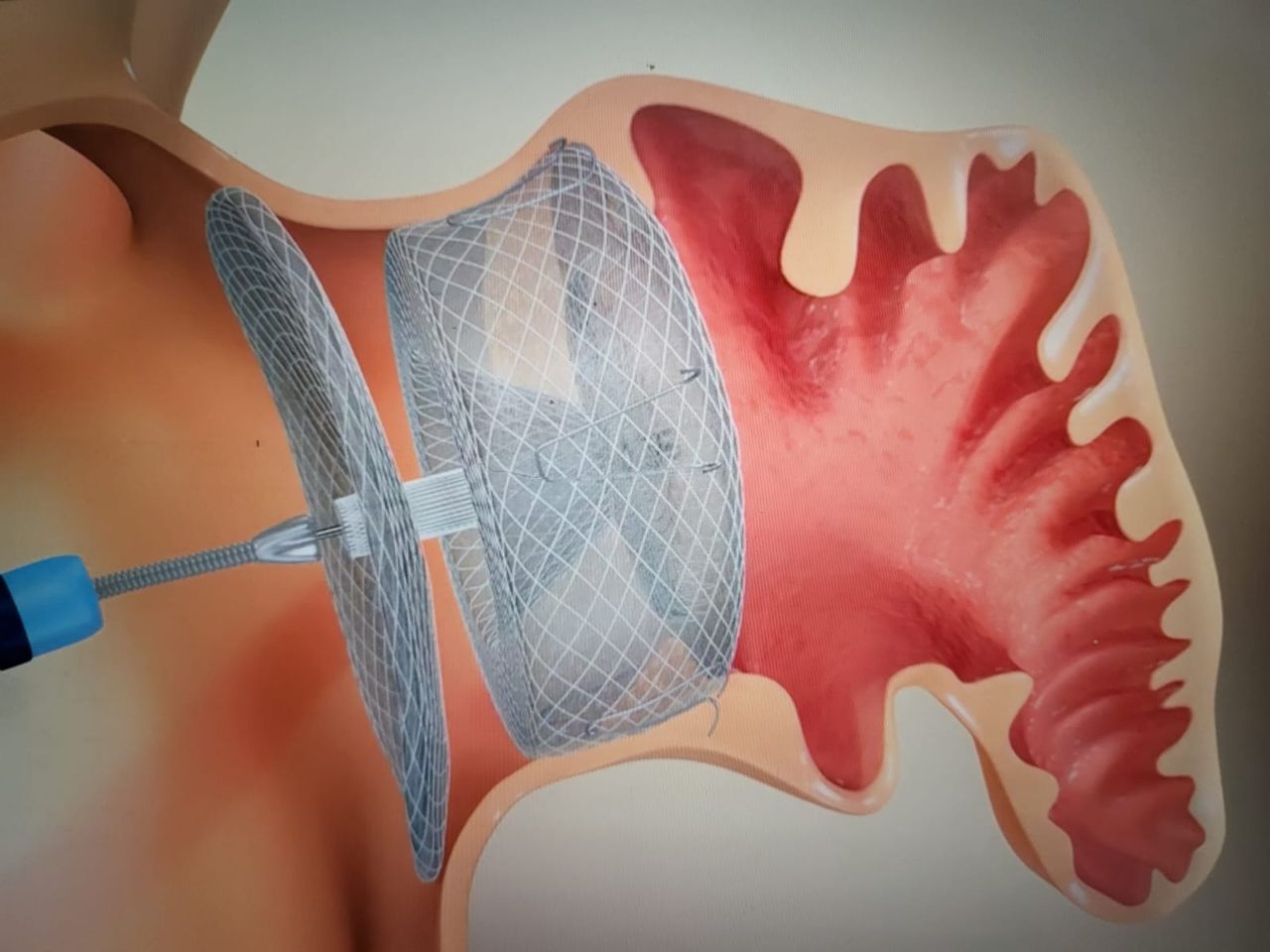 Gerardo Santiago Baca Escobar-7