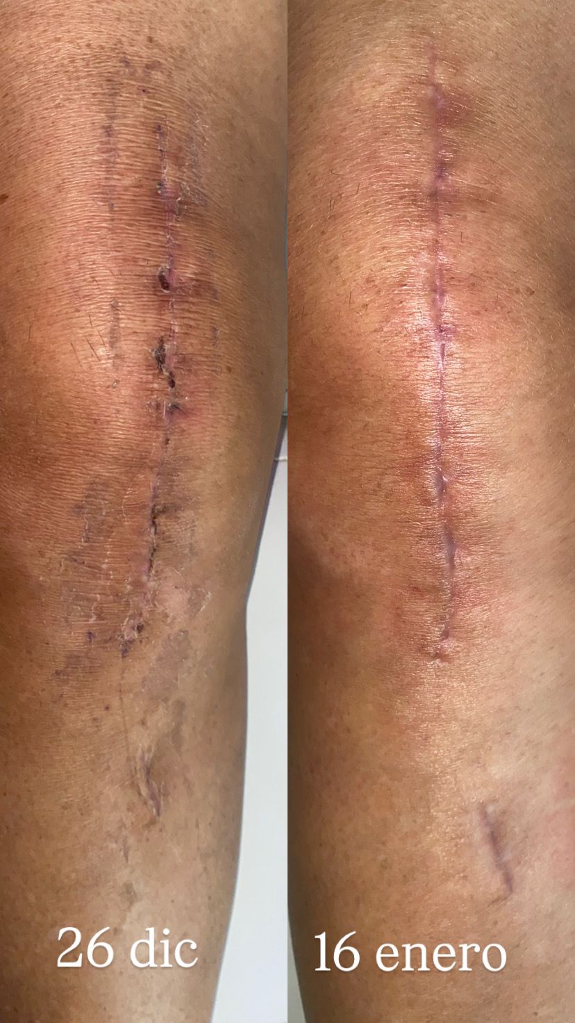 Juana Aracely Zapata Cepeda-14