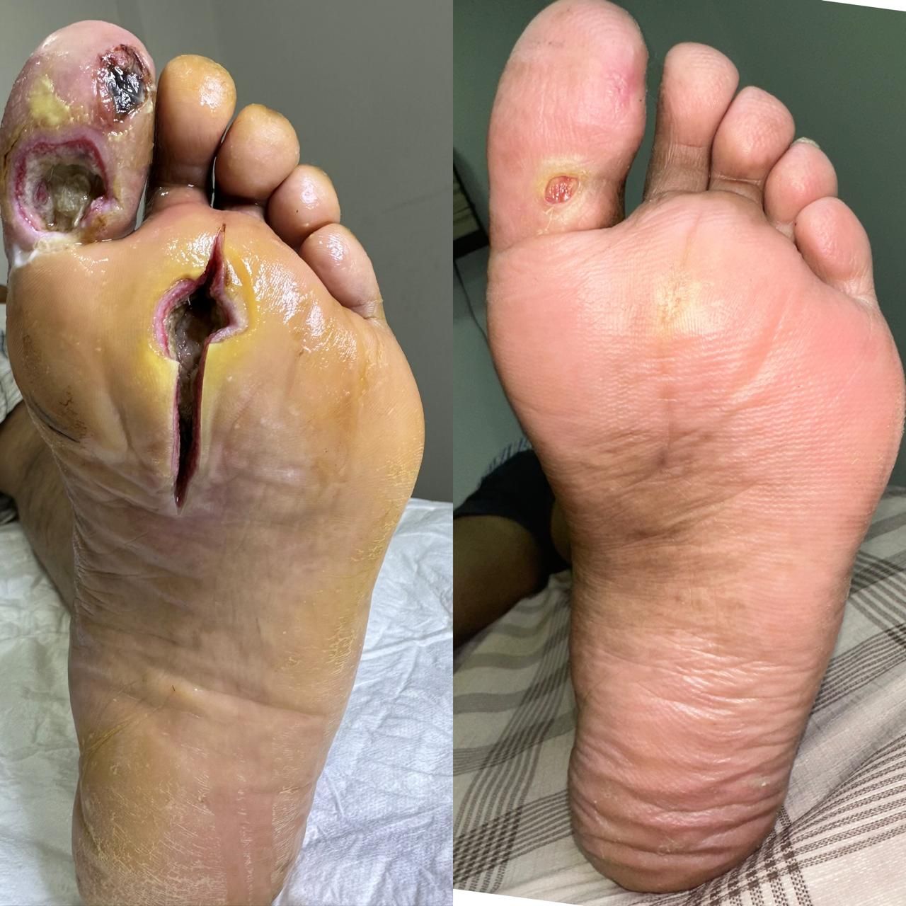 Jhonatan López González-34