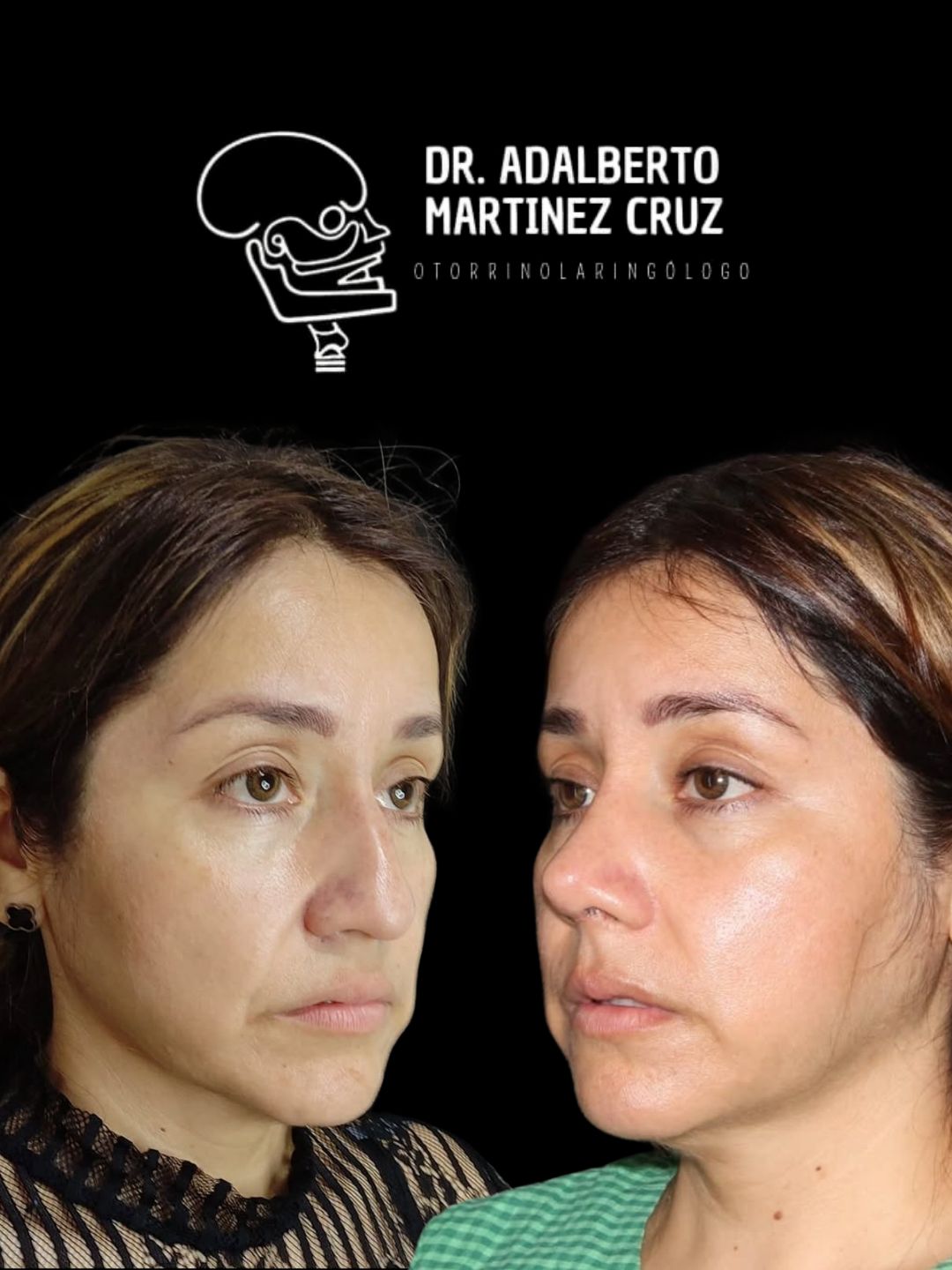 Adalberto Martínez Cruz-25