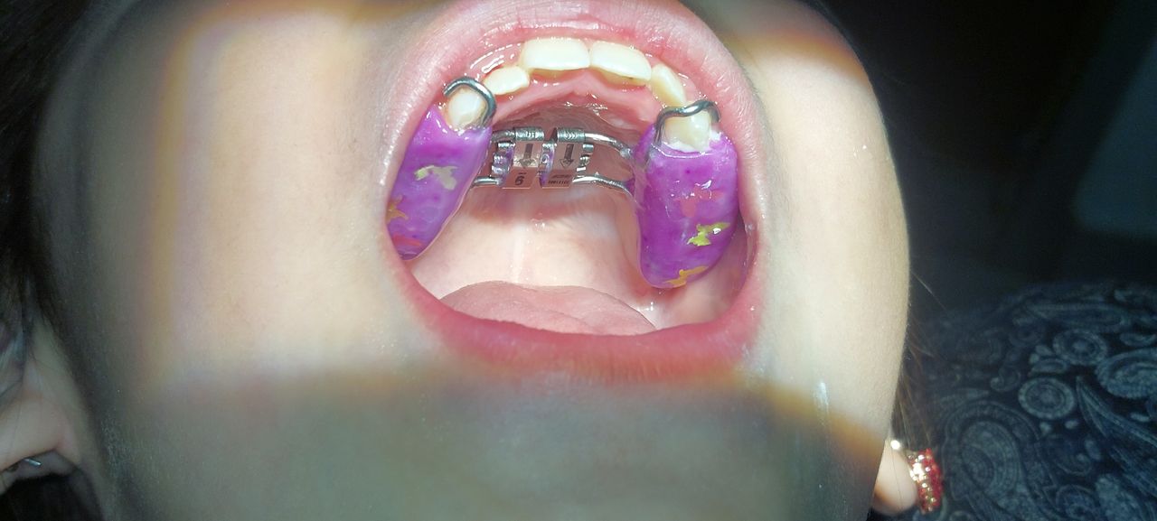 Giovanna Paola Huerta De Santiago-11