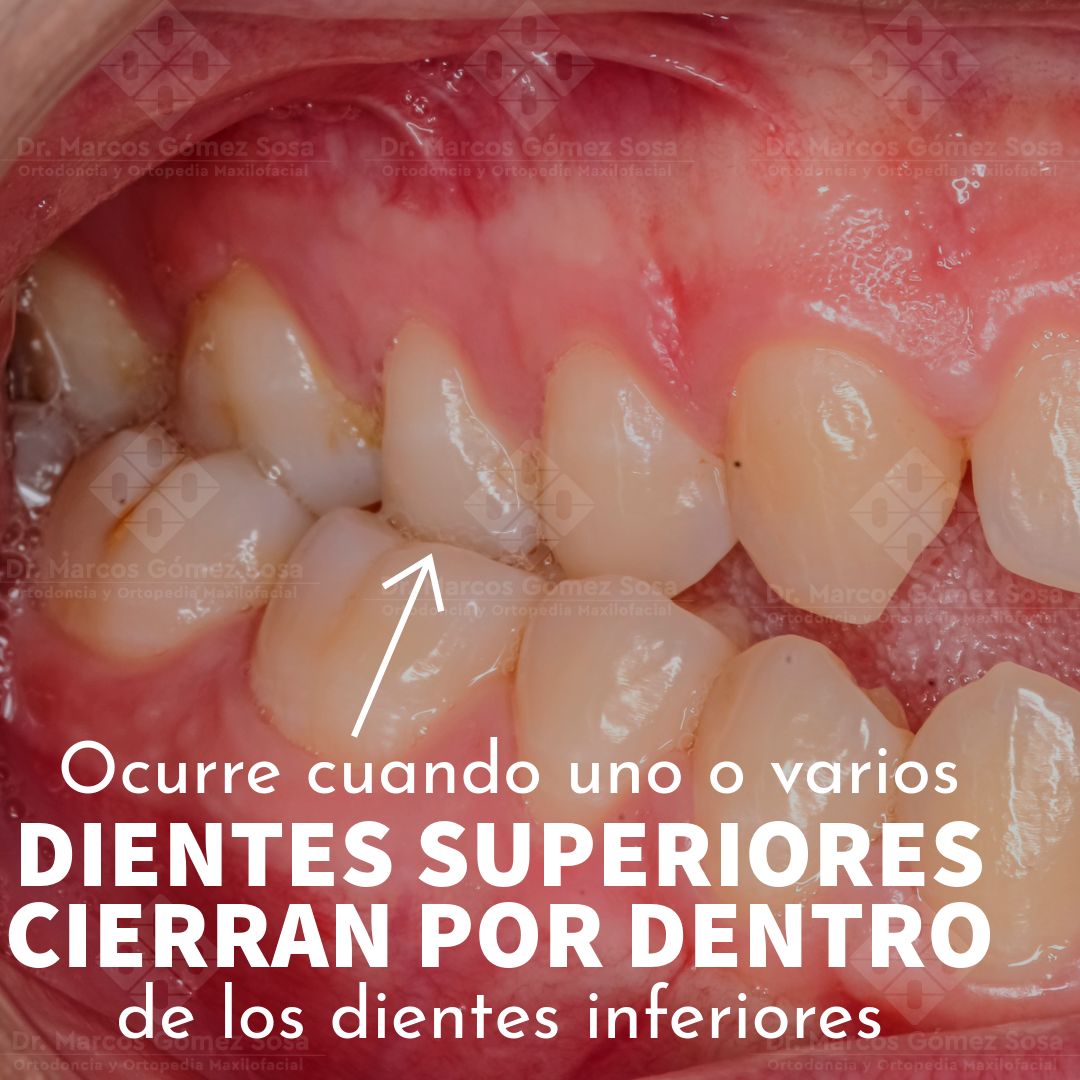 Marcos Gómez Sosa-66