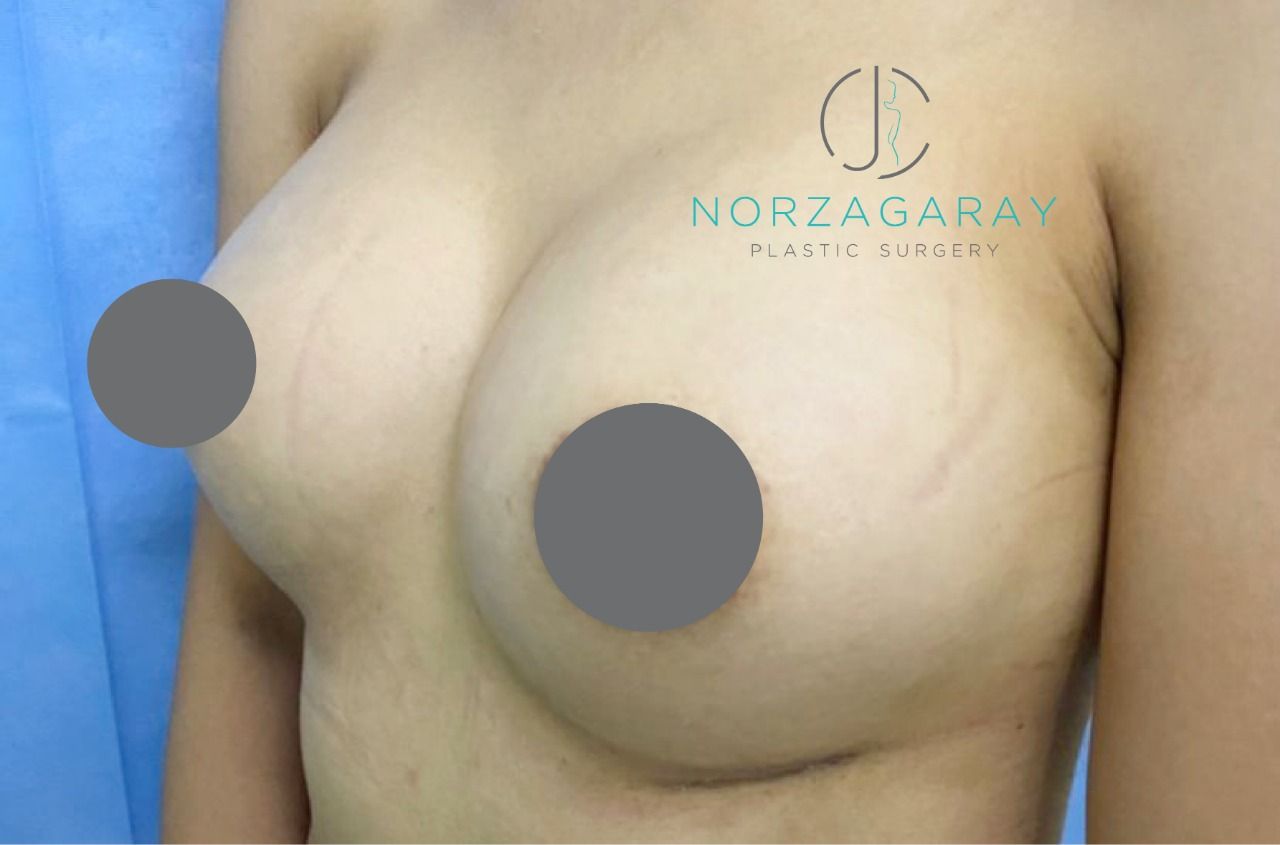 Juan Carlos Norzagaray-18