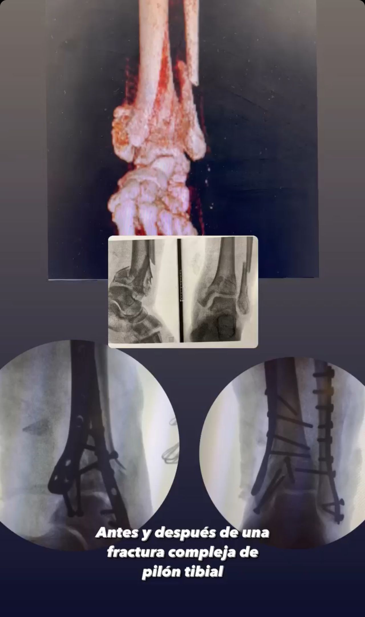 Marco Polo Malacón Gutiérrez-15