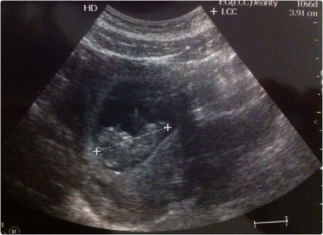 Aremi Castillo Dominguez-6