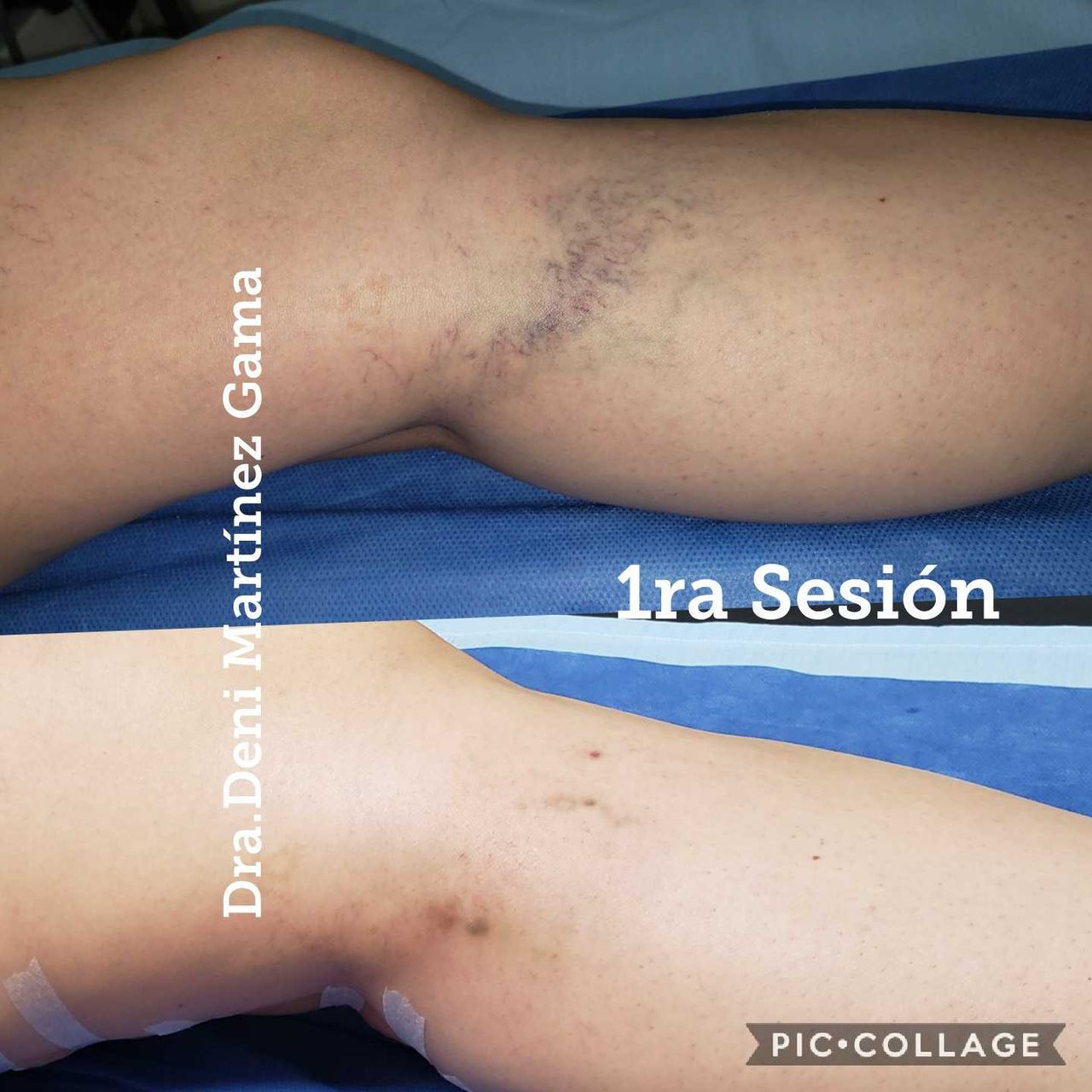 Deni Martínez Gama-15