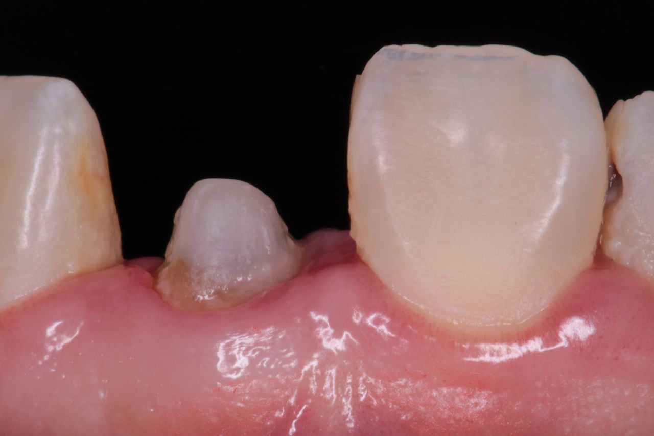 David Alan Escamilla Álvarez-0