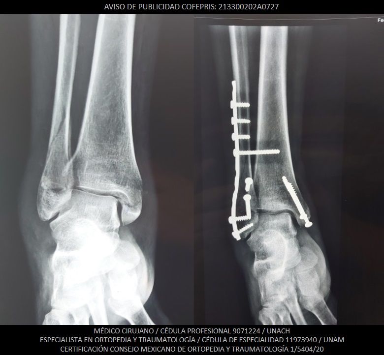 Luis Castañón Robles-11