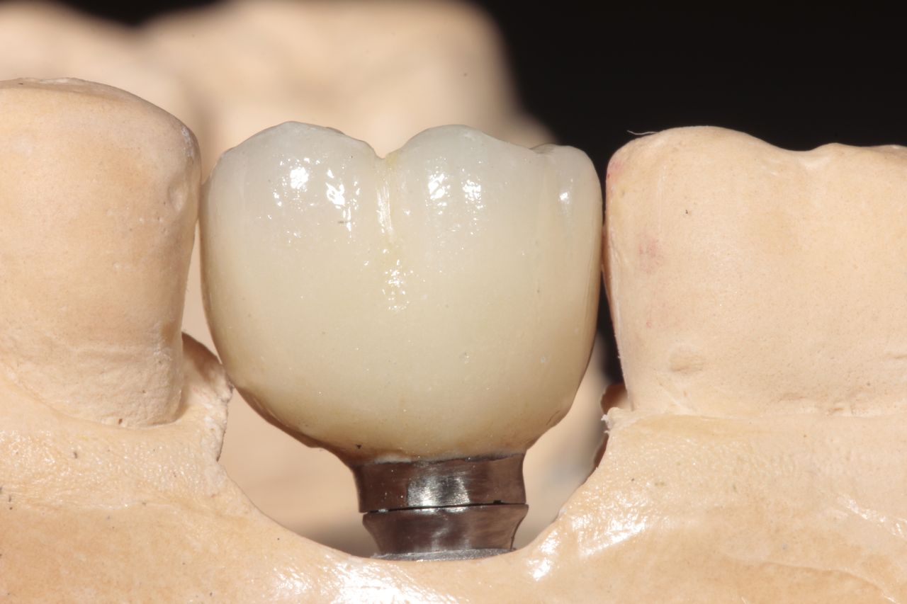 Mariel Itzayani Torres López-36