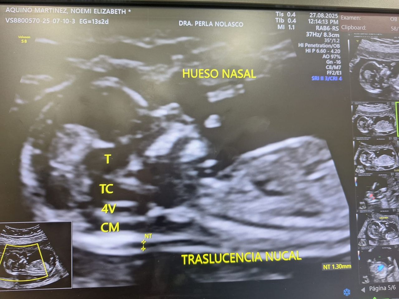 Perla Estefania Nolasco Navarro-1