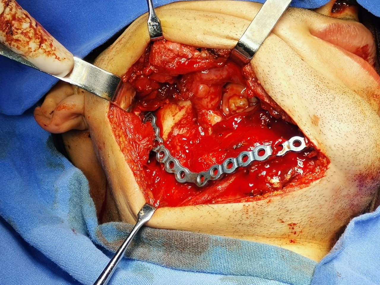 Luis Humberto Garcia Cabrera-10