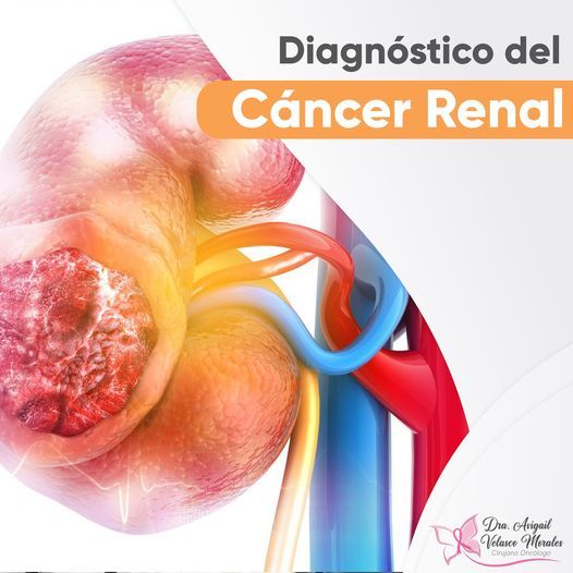 Avigail Soveida Velasco Morales-9