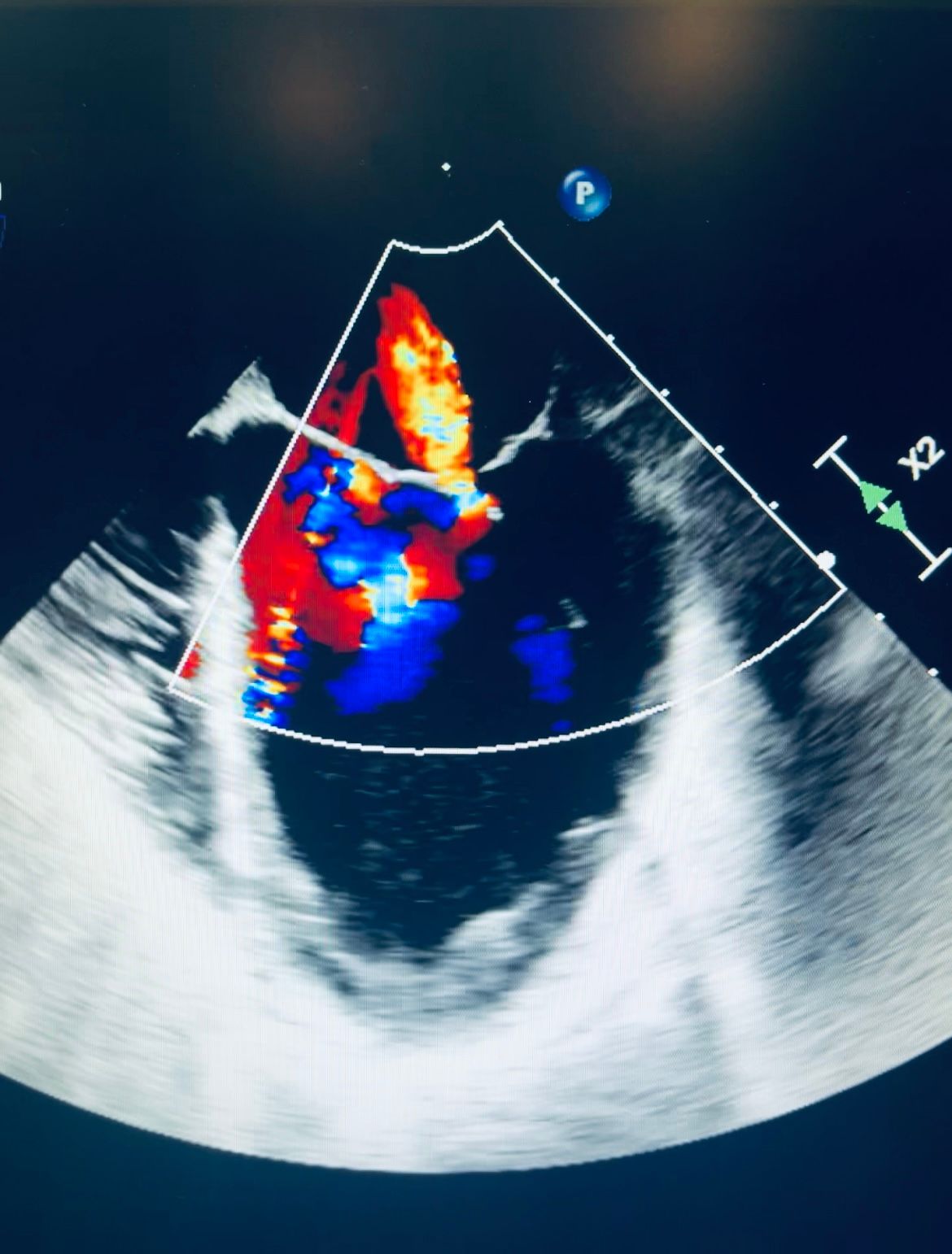 Francisco Javier Reyes Alvarez-5