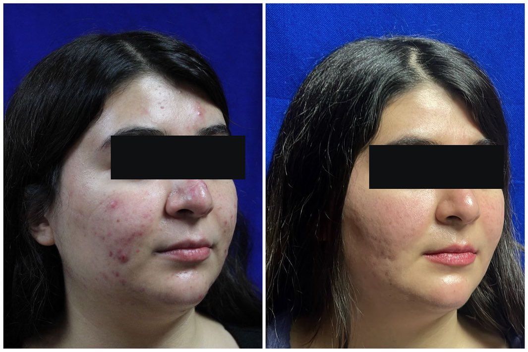 Adrián Martínez Moreno-12