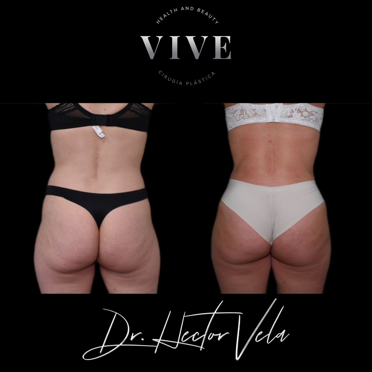 Héctor Eduardo Vela Cardona-99