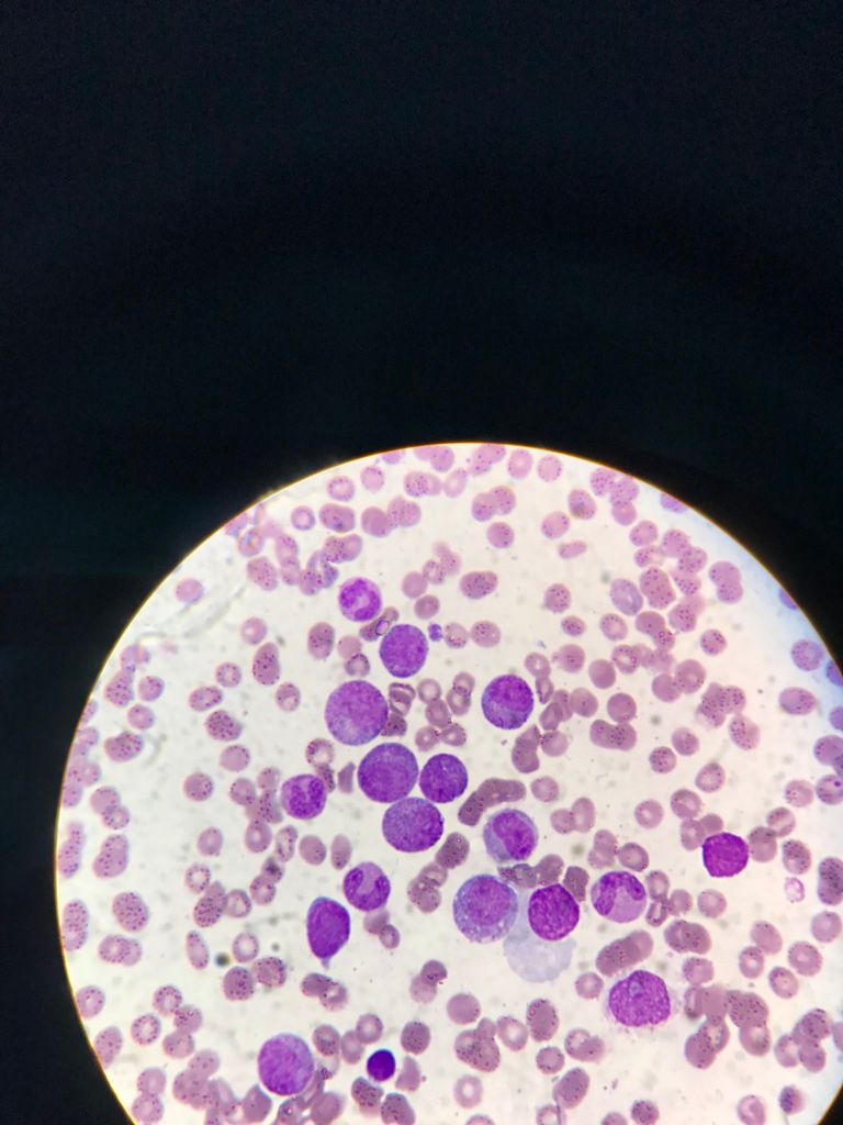 Abril Balam Canul-13