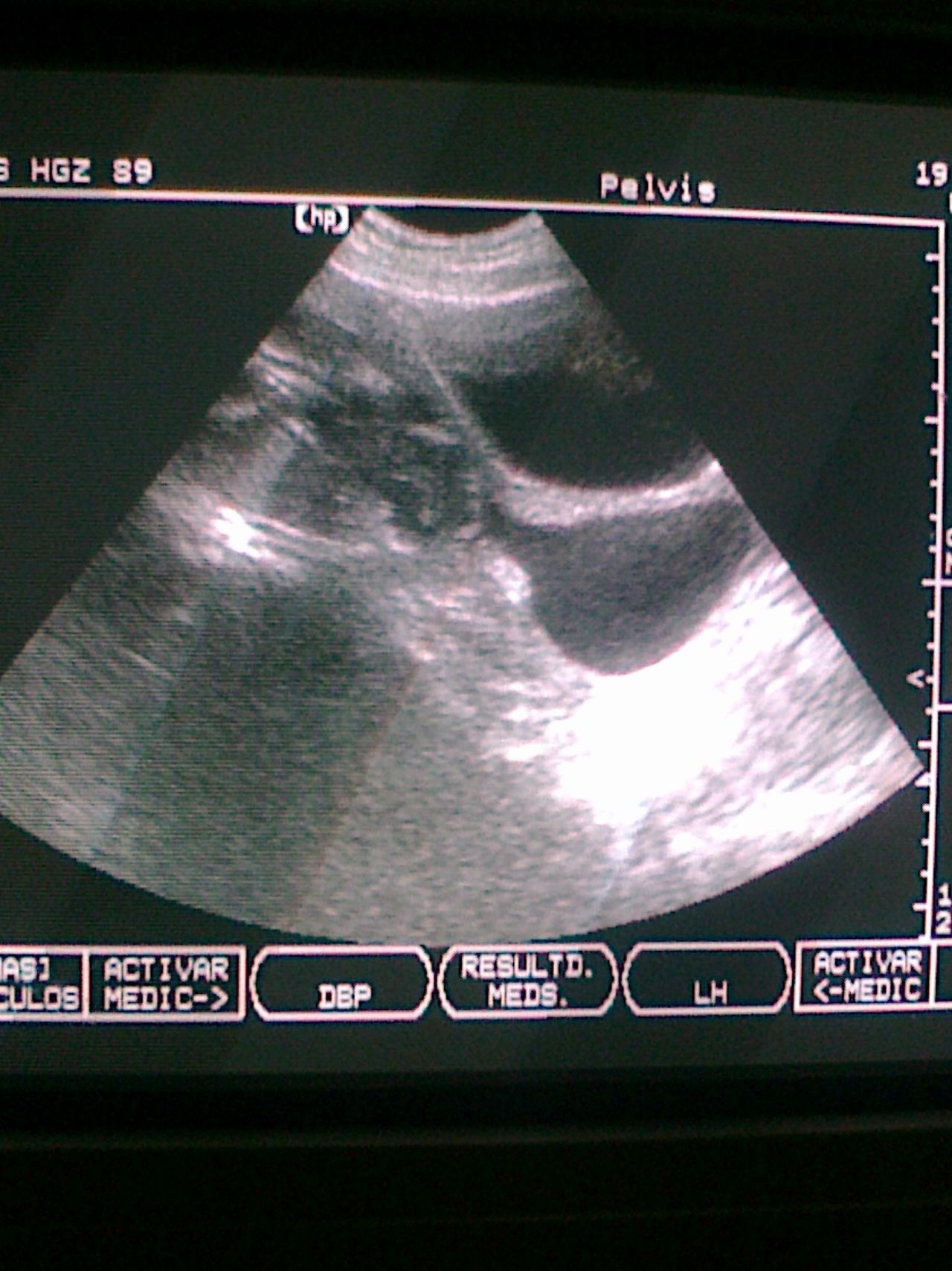 Alma Delia Arce Romero-14