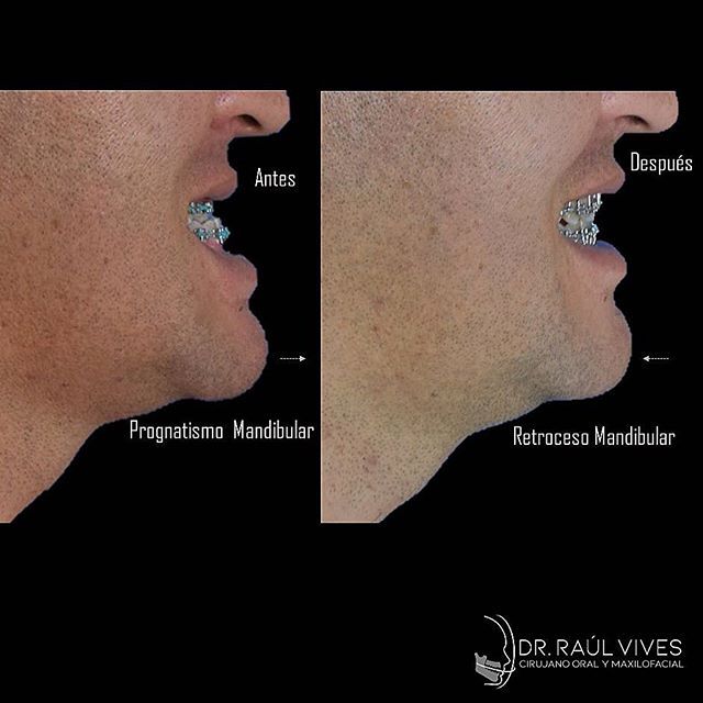 Raúl José Vives Serrano-18