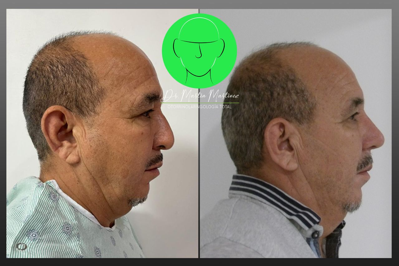 Martín Martínez Camarillo-17