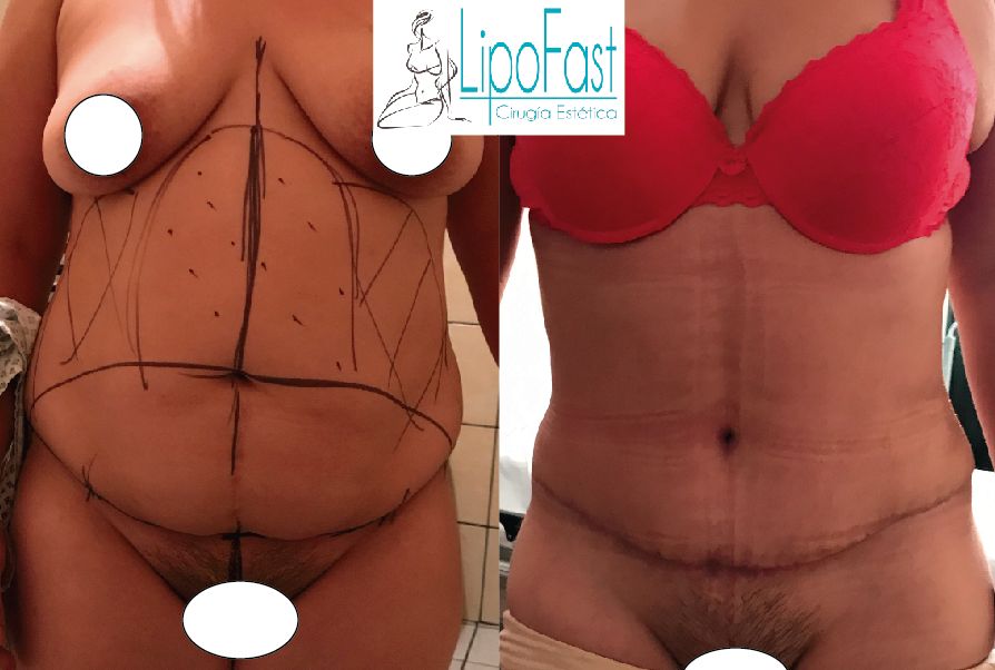 J. Antonio Meré Gómez-13