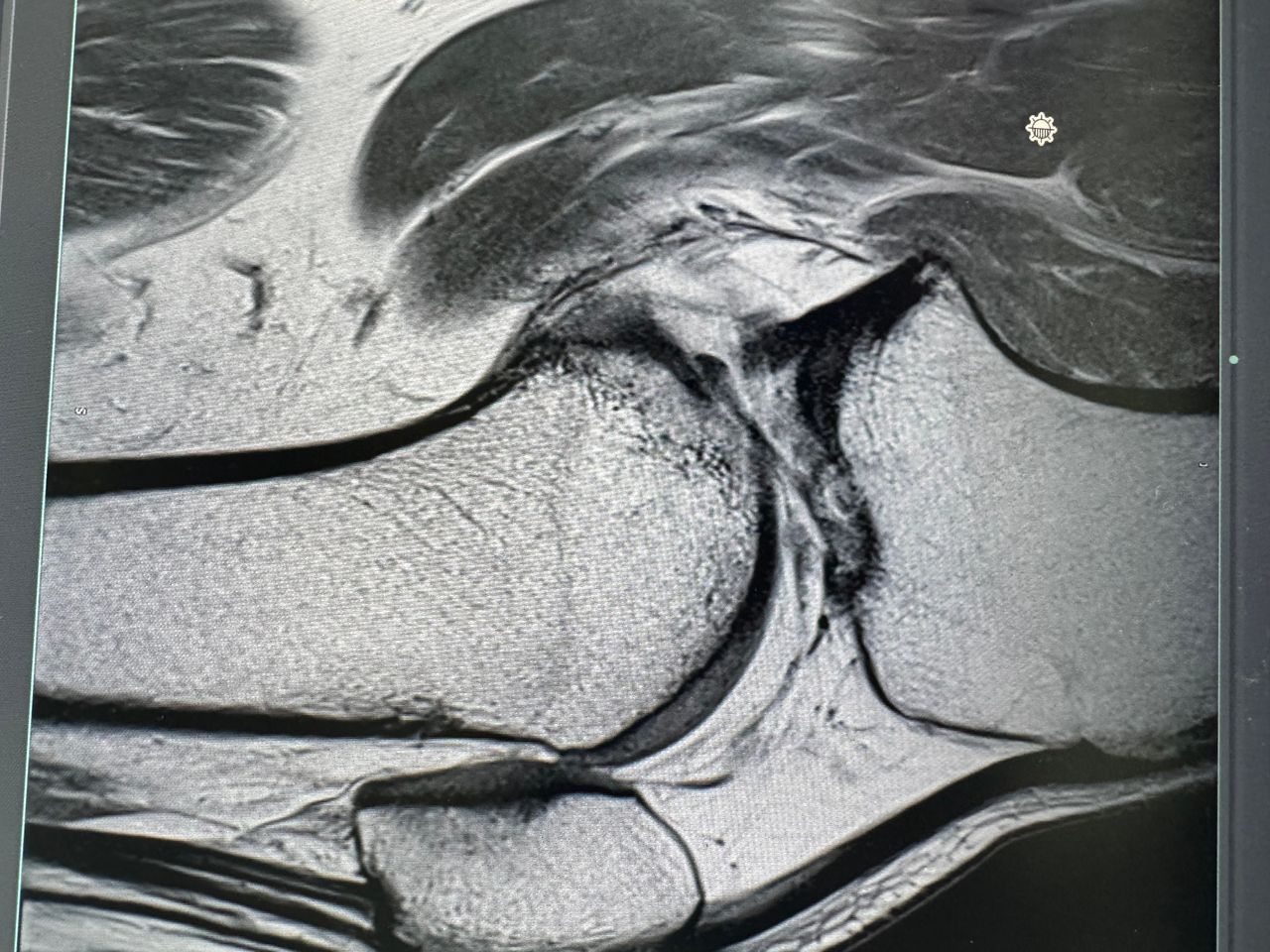 Oscar Iván Giles Mazón-4