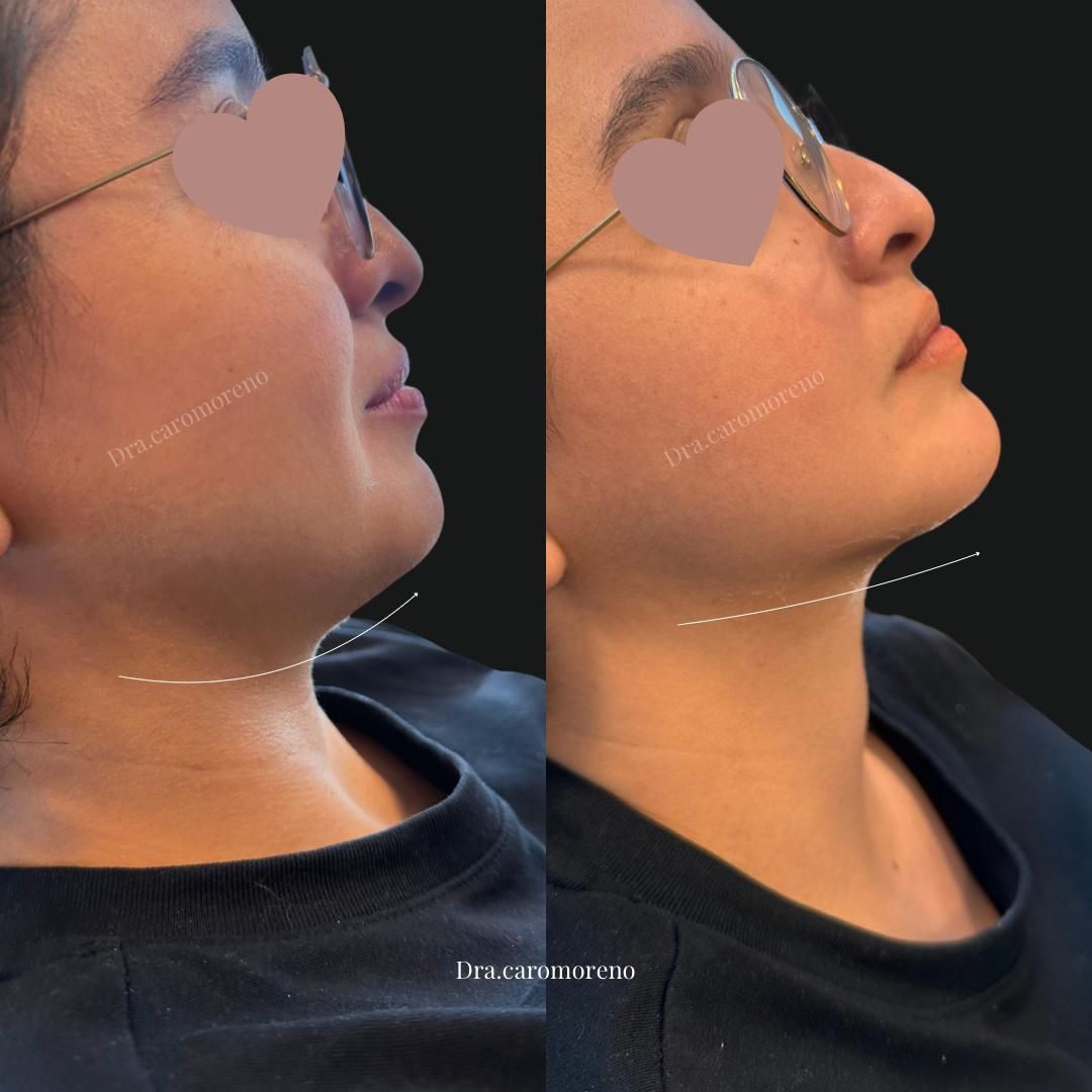 Jazmin Carolina Moreno Galvan-12