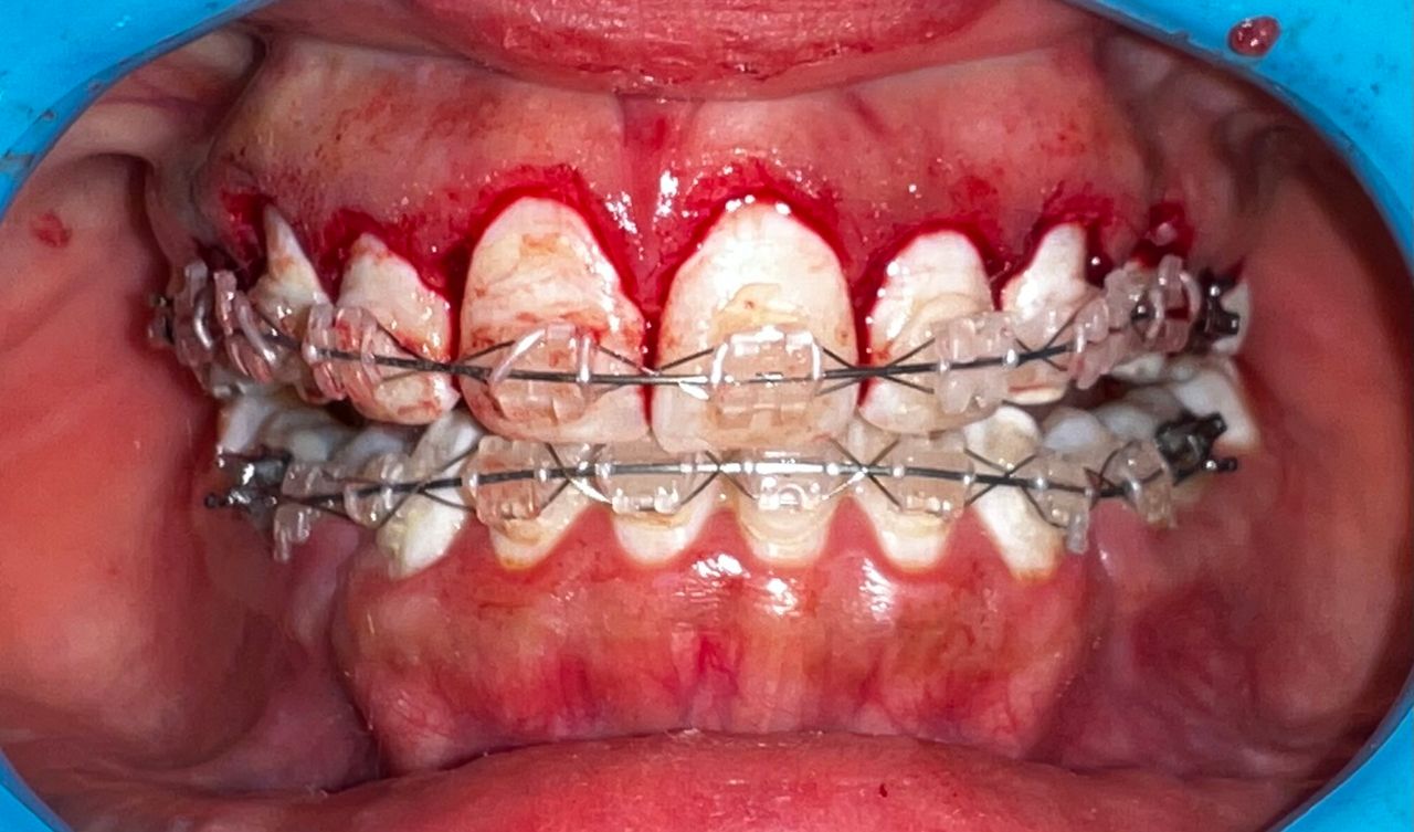 Oswaldo Sanchez Gonzalez-3