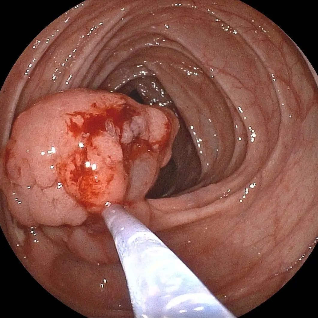 Edgar Alan De León Rojas-13